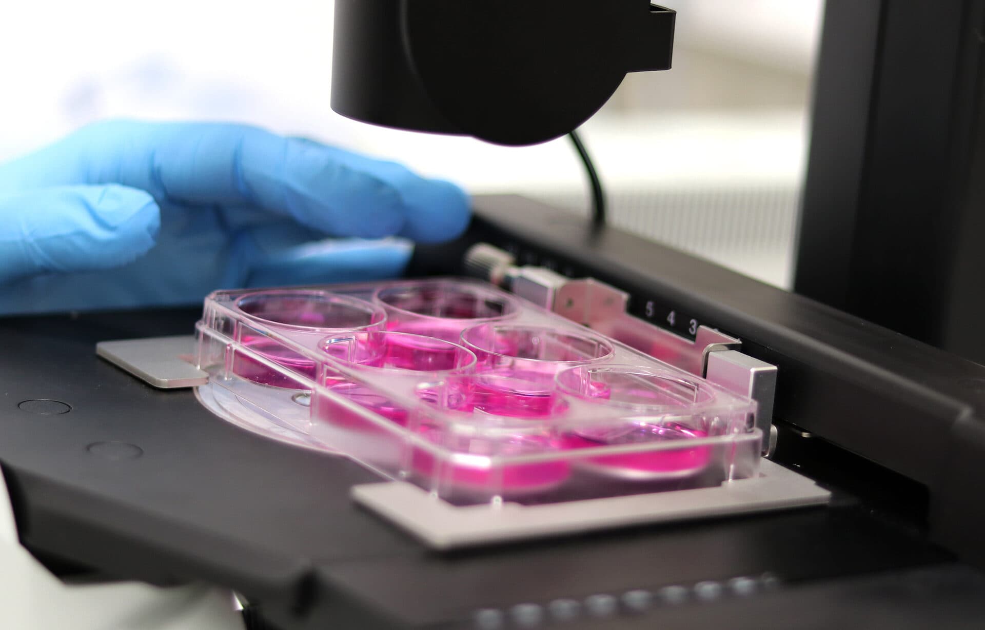 3D patient-derived cancer organoid