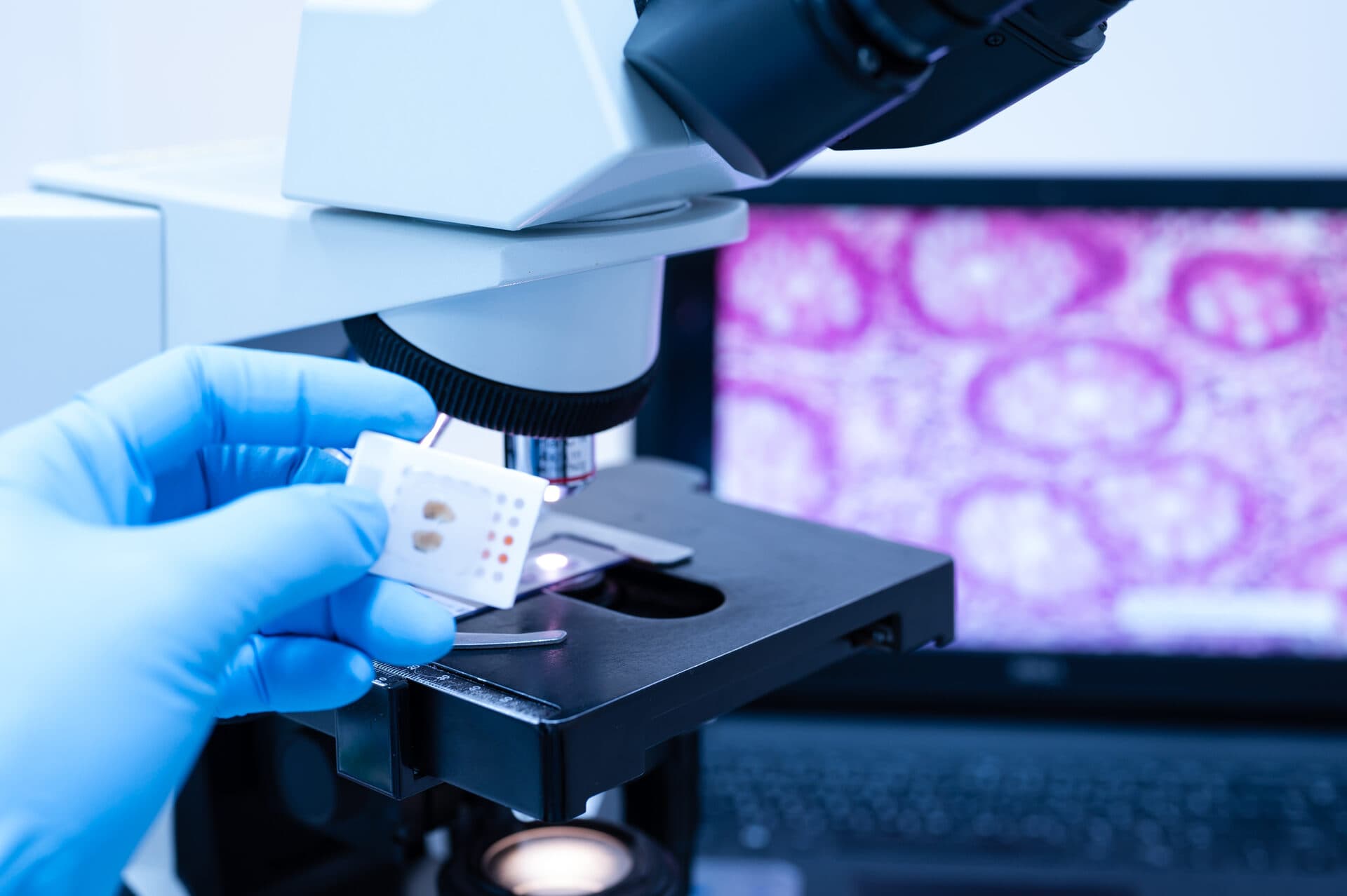 Tissue engineering process